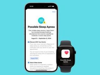 thumbnail - Apple Watch